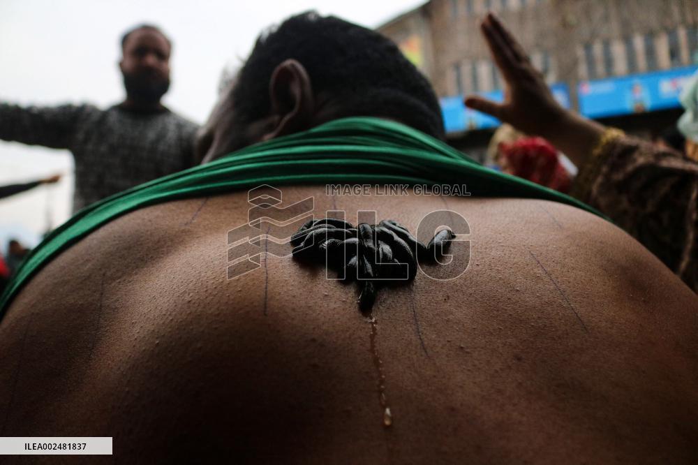 Leech Therapy Treatments - India