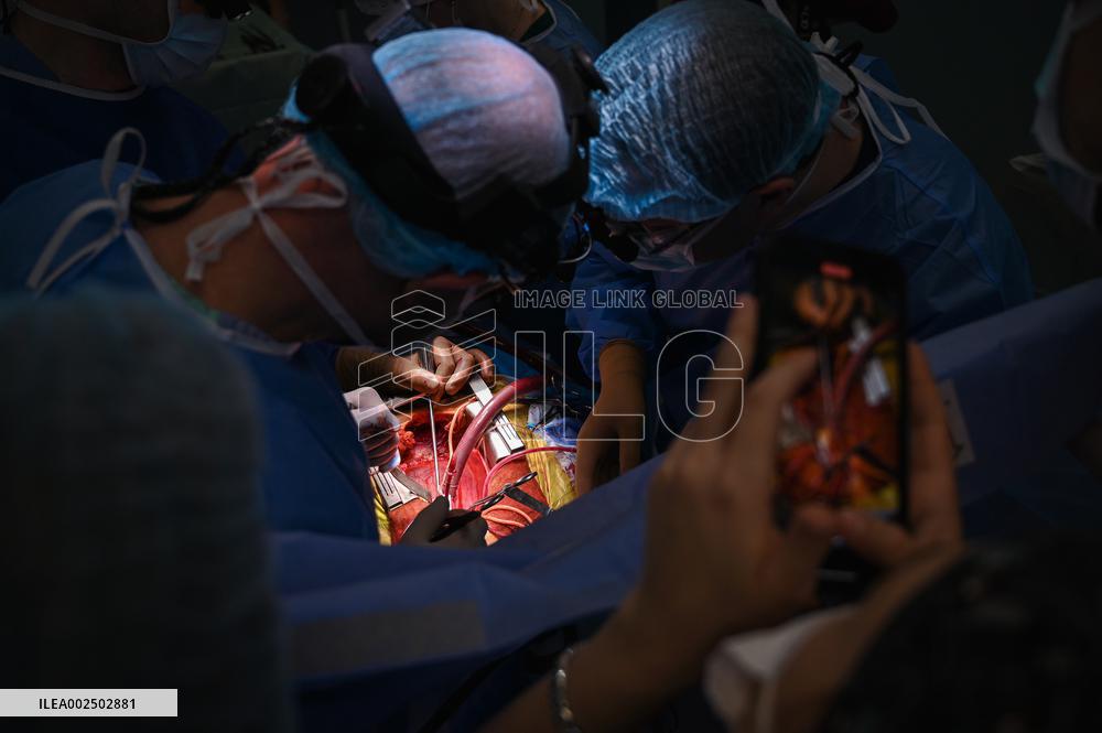 Ferrazzi method open heart surgery first ever performed in Lviv