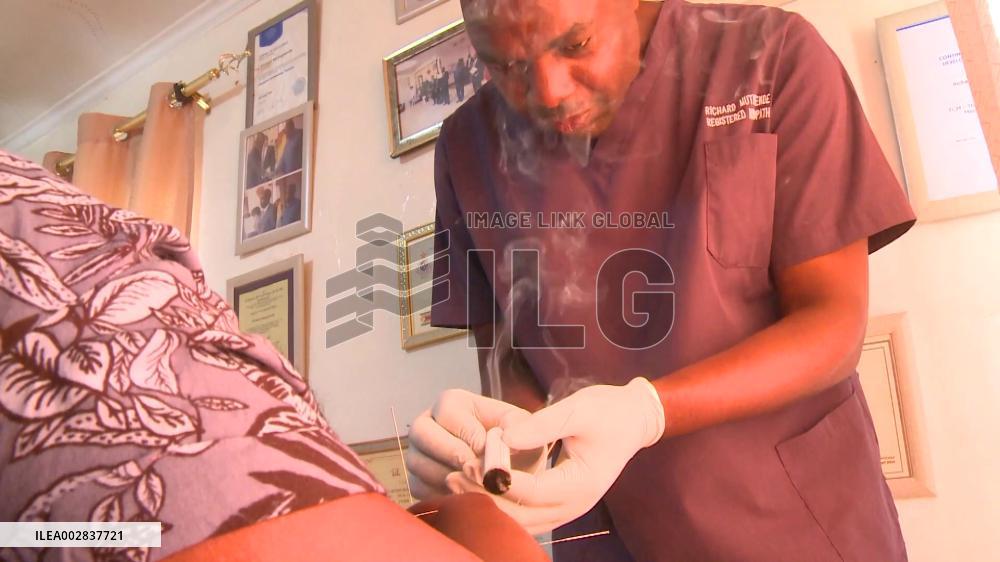 Chinese acupuncture works wonders for Zimbabweans