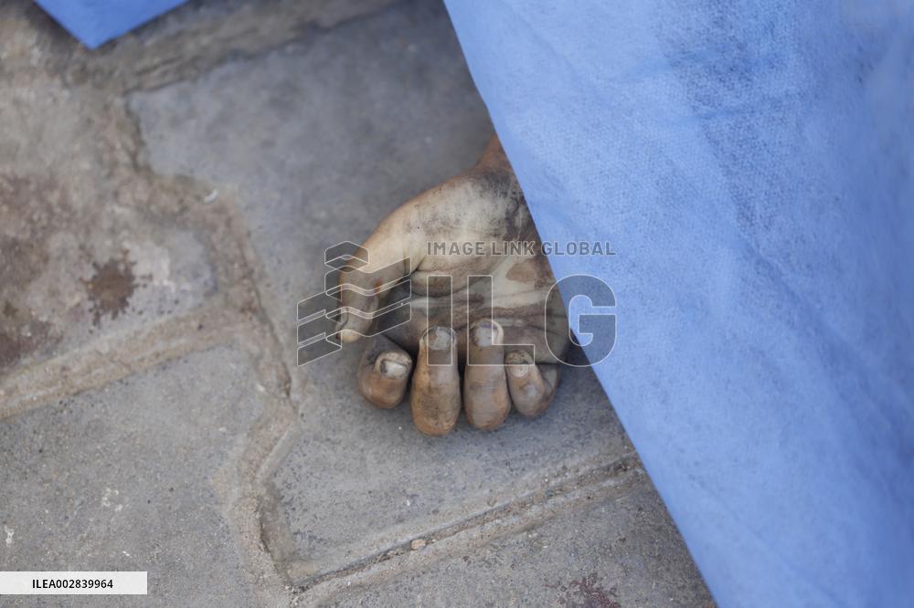 Victims of Israeli Attack On Nuseirat Camp At Al-Aqsa Martyrs Hospital