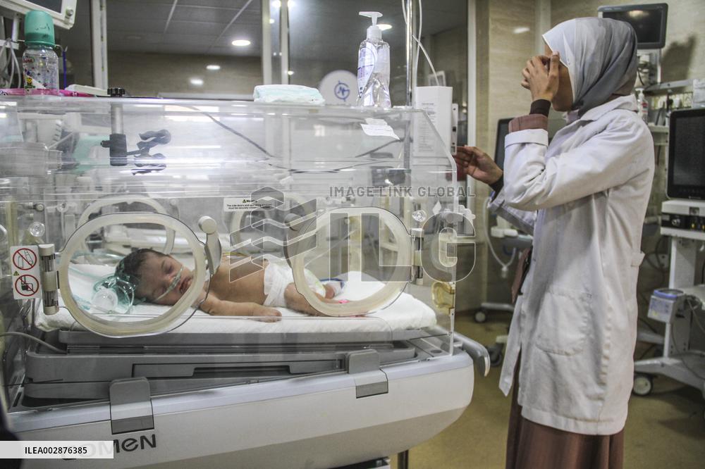MIDEAST-GAZA-HOSPITAL-MALNUTRITION-CHILD