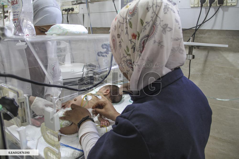 MIDEAST-GAZA-HOSPITAL-MALNUTRITION-CHILD