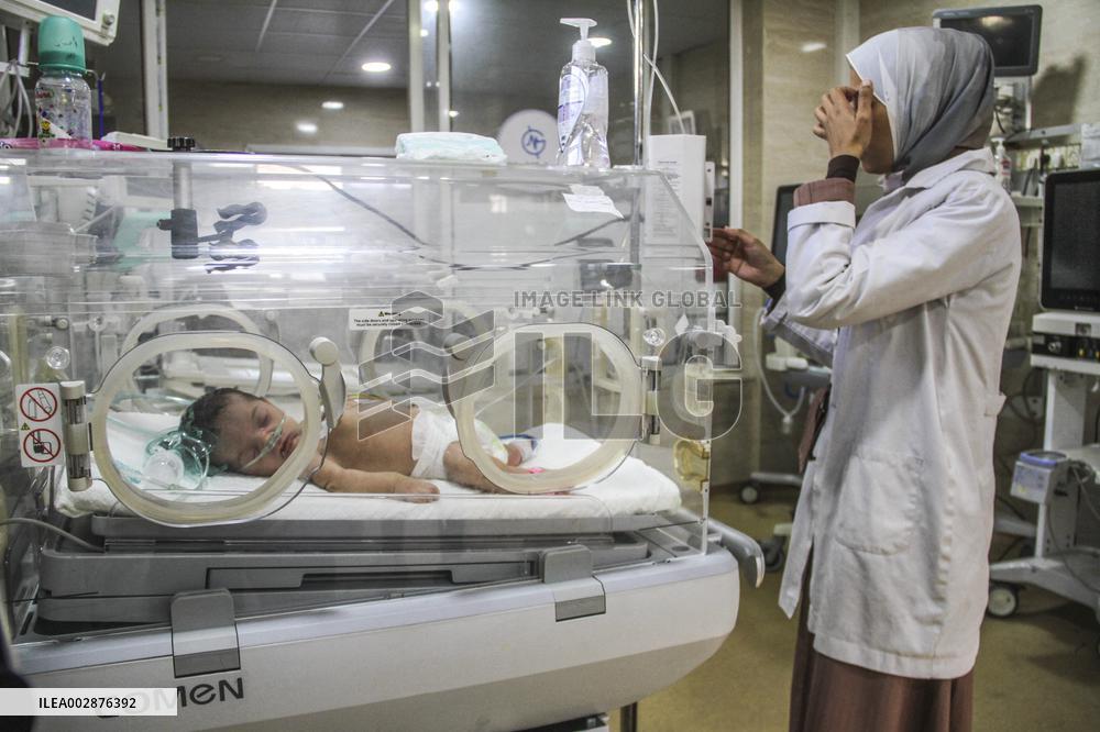 MIDEAST-GAZA-HOSPITAL-MALNUTRITION-CHILD