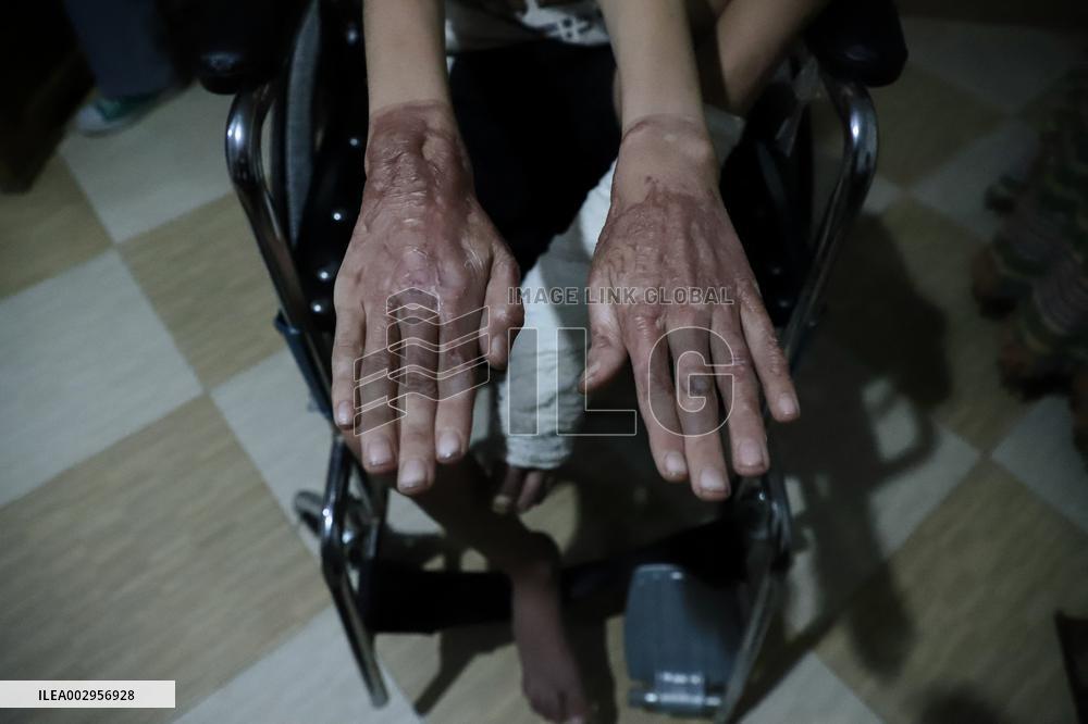 Children's Lives Threatened By Rising Malnutrition - Gaza