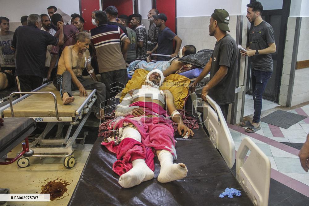 MIDEAST-GAZA CITY-ISRAEL-ATTACKS-INJURED PEOPLE