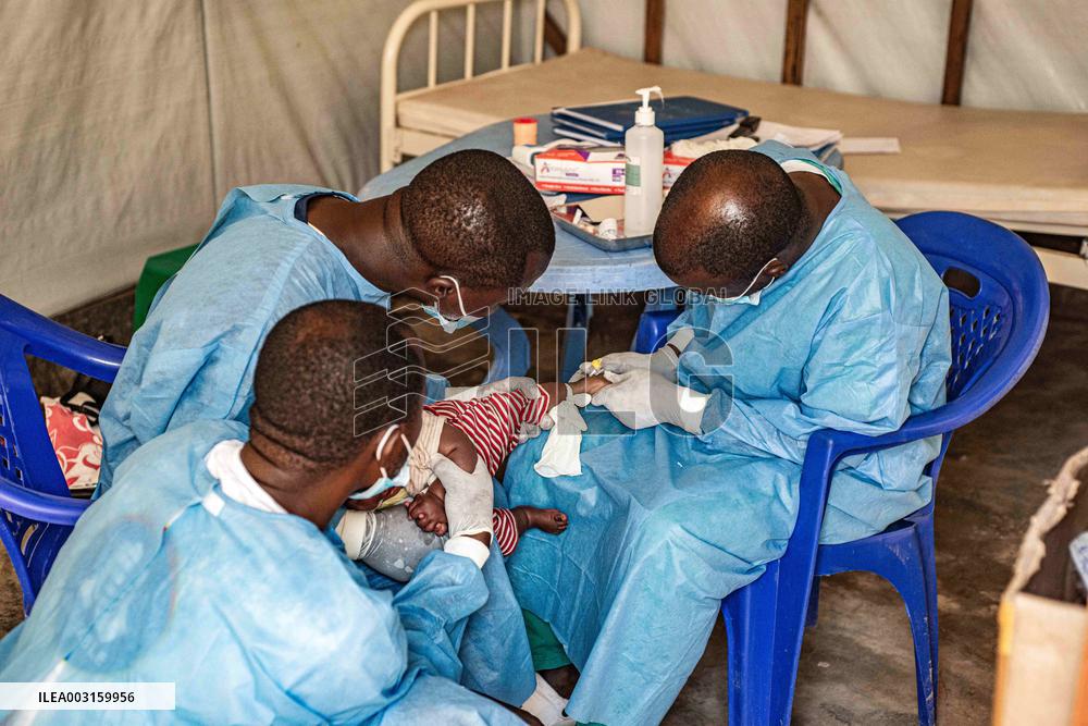 WHO Declares Mpox A Global Public Health Emergency