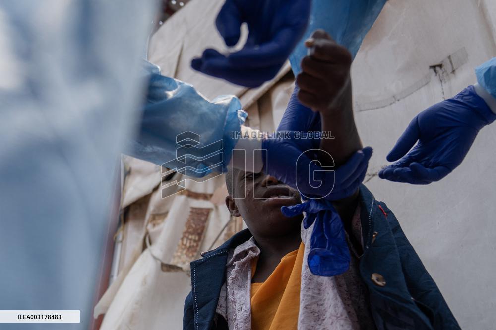 Mpox Cases Rise To 16,700 As Country Awaits Vaccines - DRC