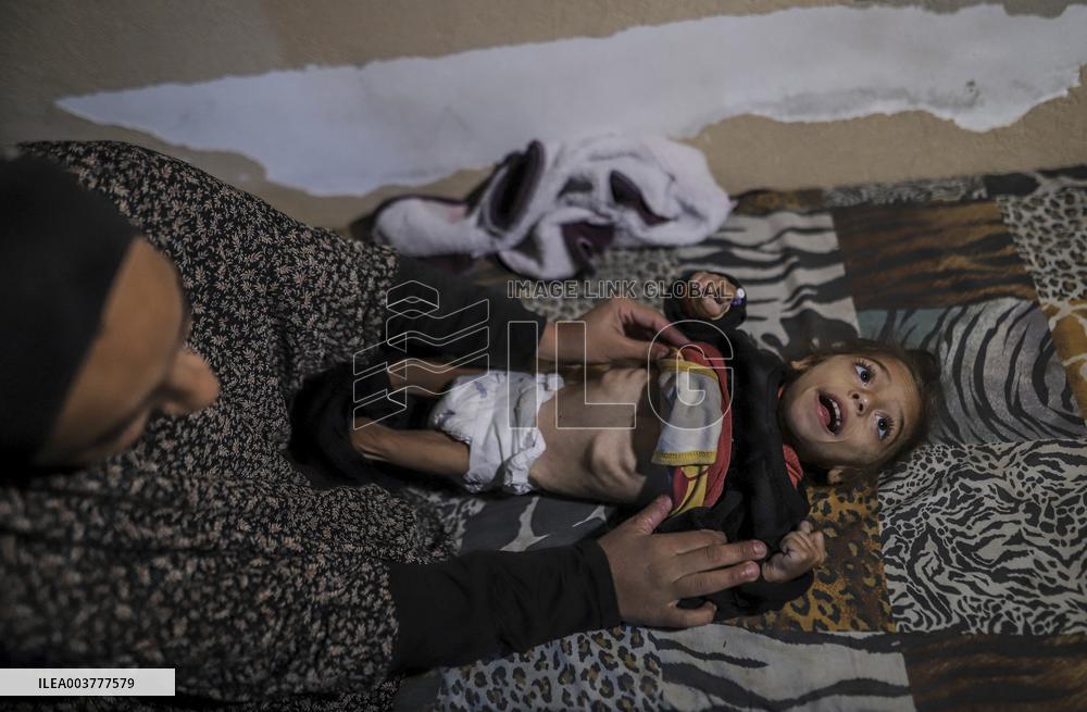 Displaced Families Face Harsh Winter - Gaza