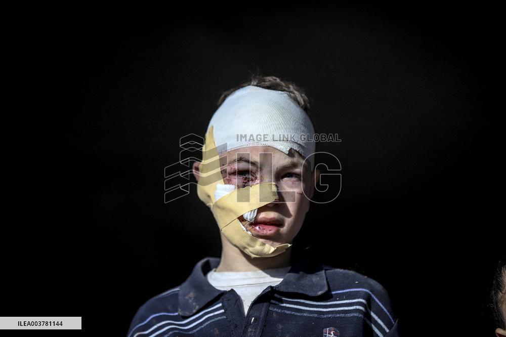 Gaza Death Toll Nears 45,000