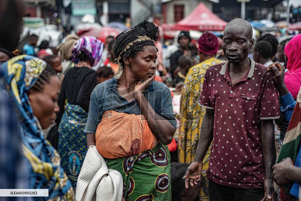 Intensified DRC fighting displaces 35,000 civilians, injures 9 peacekeepers - Goma