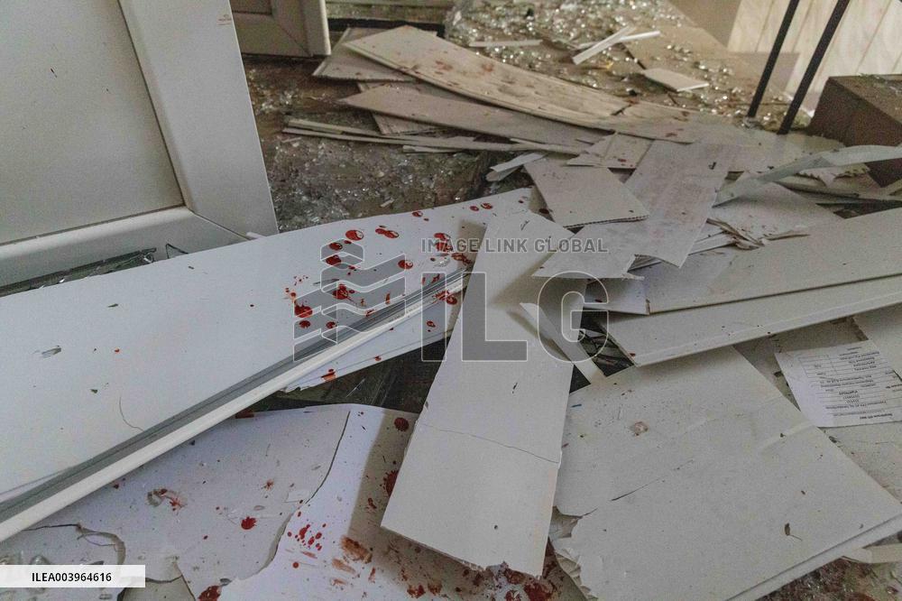 5 People Killed In Russian Attack On Izyum