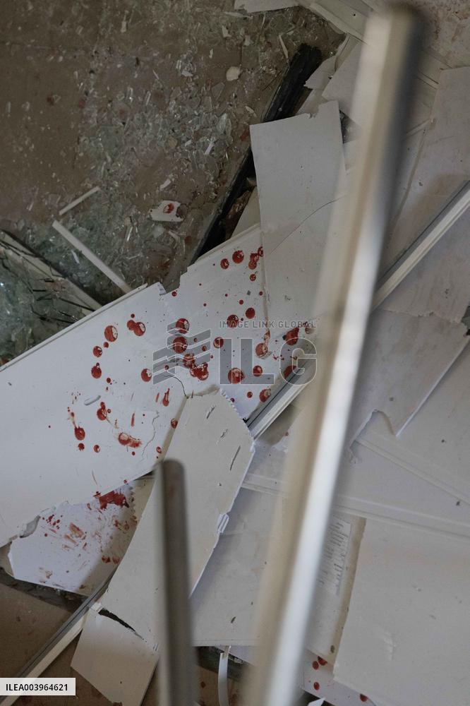 5 People Killed In Russian Attack On Izyum