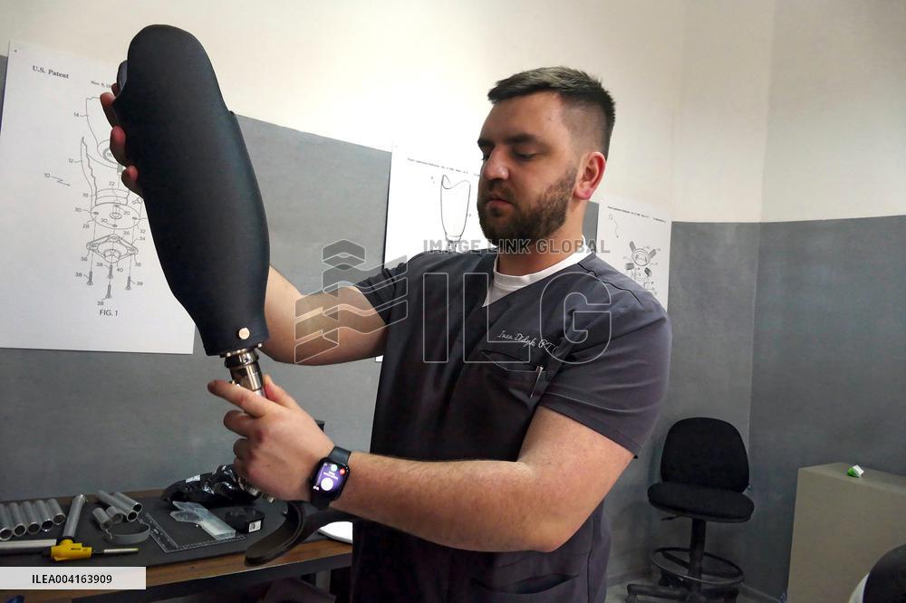 Zakarpattia Regional Hospital produces 3D prostheses for military in Ukraine