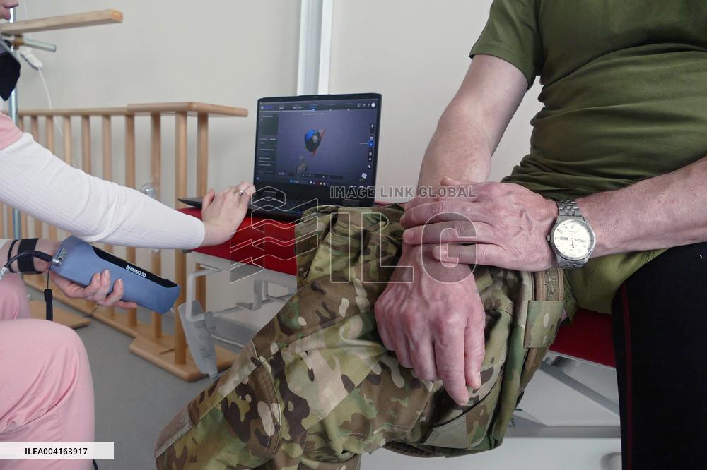 Zakarpattia Regional Hospital produces 3D prostheses for military in Ukraine