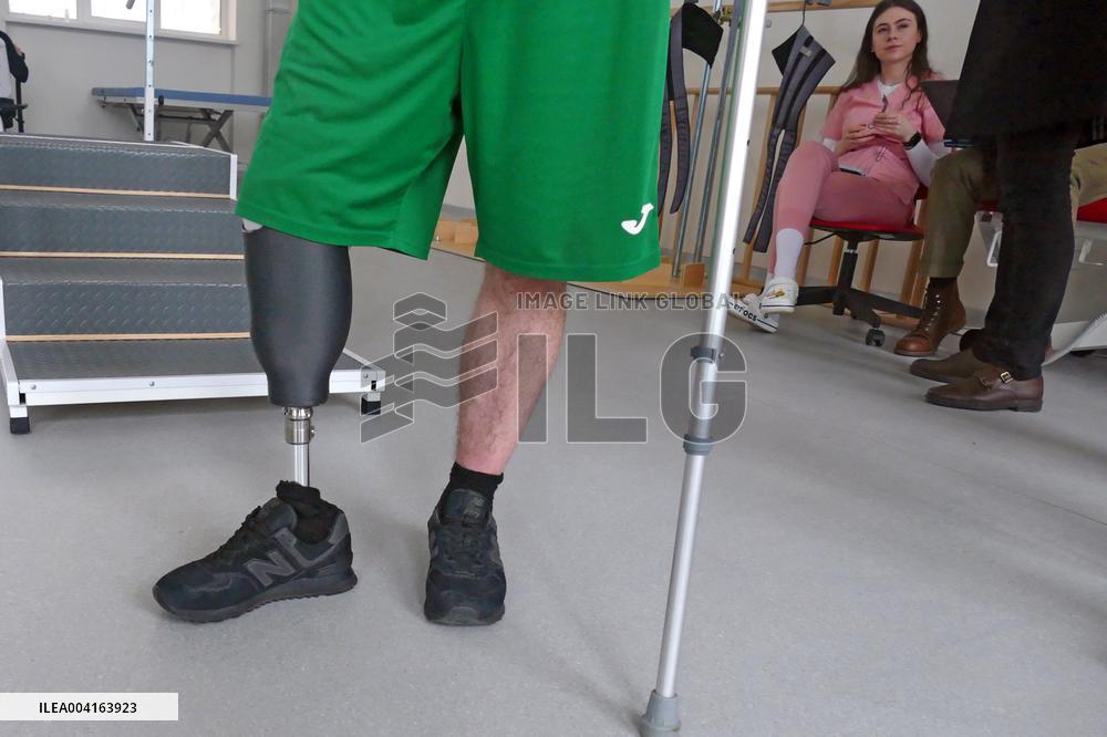 Zakarpattia Regional Hospital produces 3D prostheses for military in Ukraine
