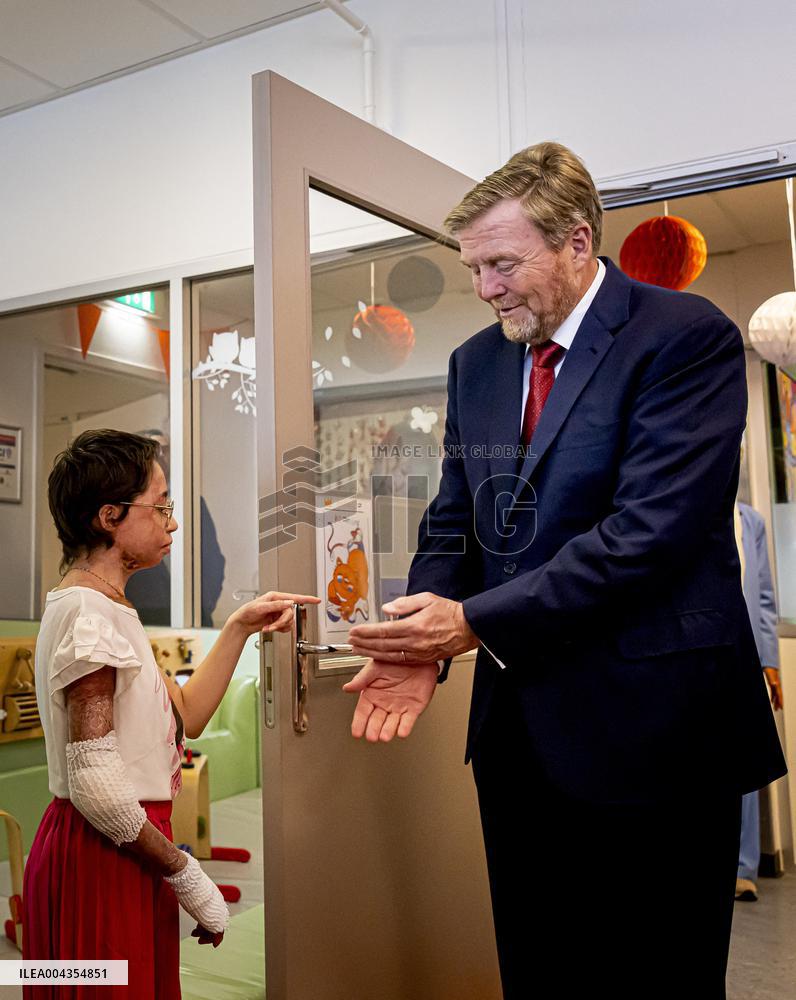 King Willem Alexander visits Beverwijk Burns Center - Netherlands
