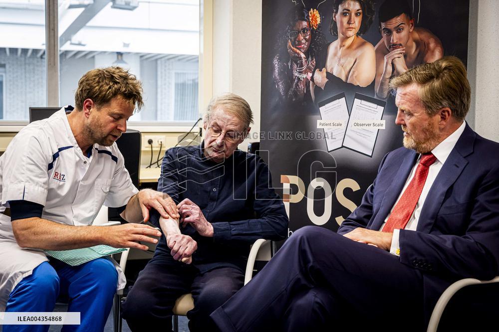 King Willem Alexander visits Beverwijk Burns Center - Netherlands