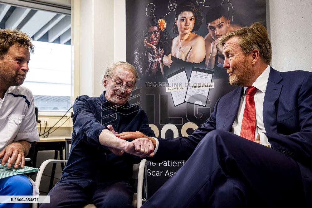 King Willem Alexander visits Beverwijk Burns Center - Netherlands