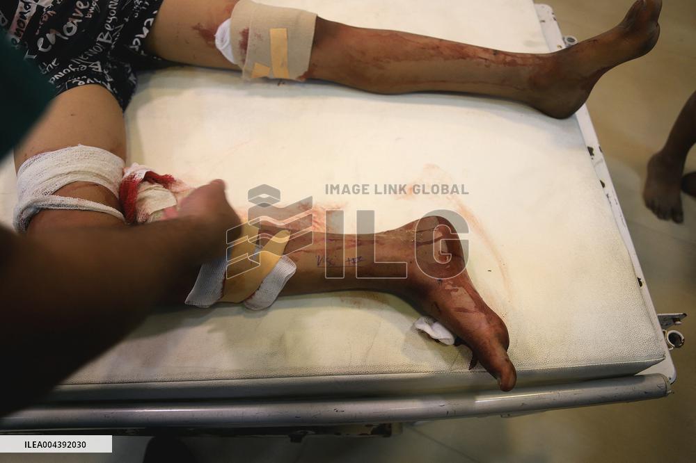 Victims of The Israeli Bombing - Gaza