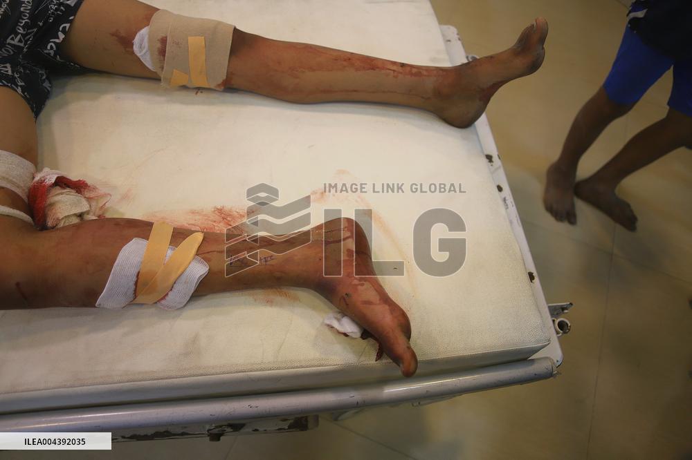 Victims of The Israeli Bombing - Gaza