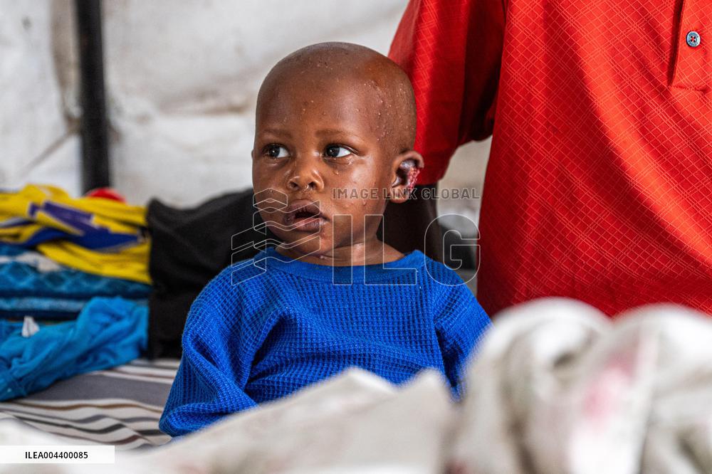 Ndosho Hospital in Conflict Zone of Goma - DRC