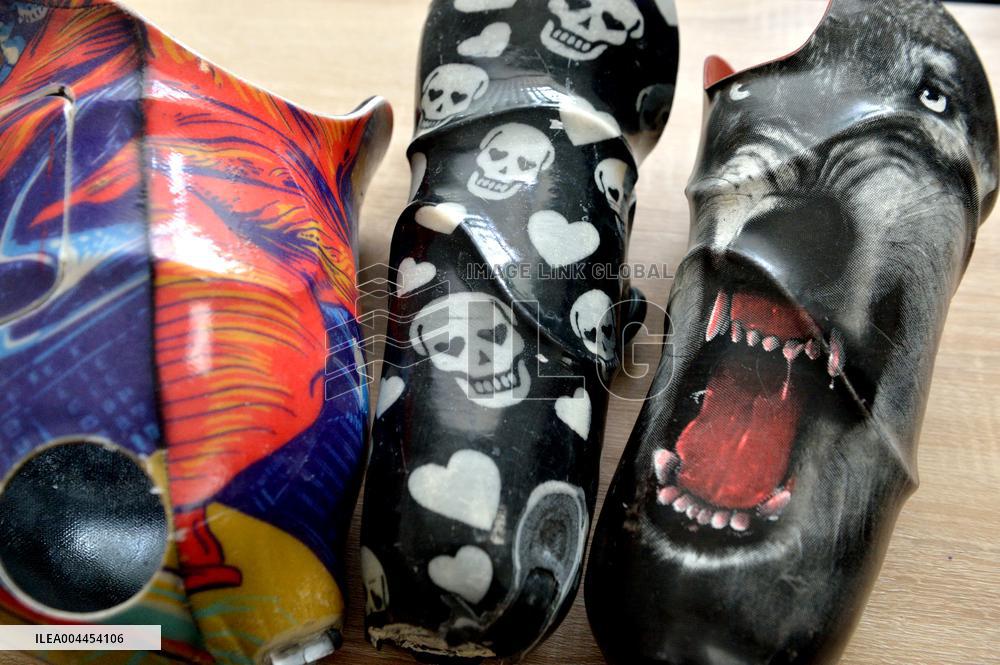 Bez Ombezhen Rehabilitation Centre in Kyiv