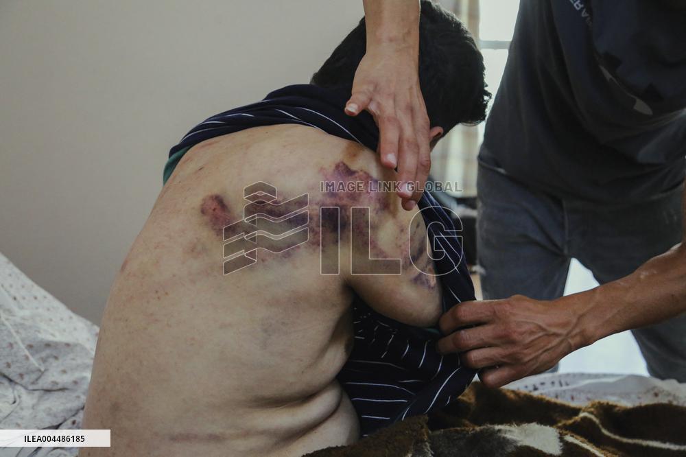 Jericho Arrest Leads To Hospitalization - Palestine