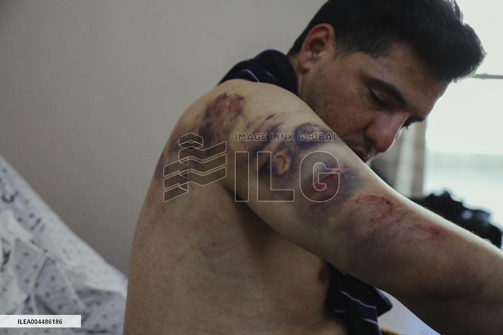 Jericho Arrest Leads To Hospitalization - Palestine