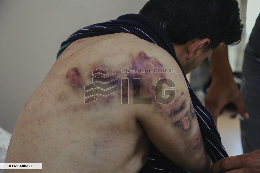 Jericho Arrest Leads To Hospitalization - Palestine