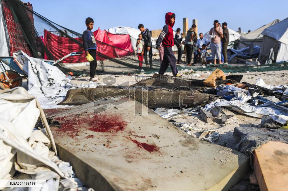 At Least 54,510 People Were Killed in Gaza