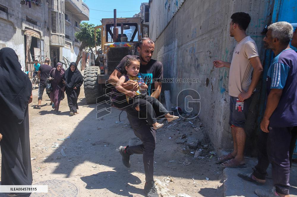Gaza Airstrike Aftermath - Injured Child in Jabalia