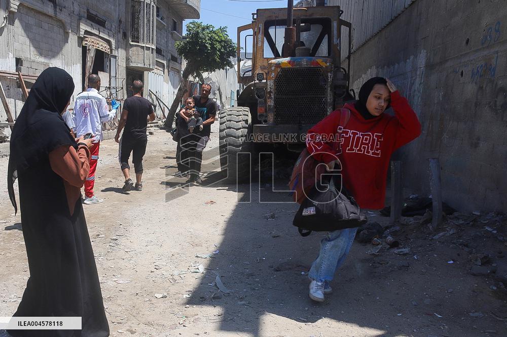 Gaza Airstrike Aftermath - Injured Child in Jabalia