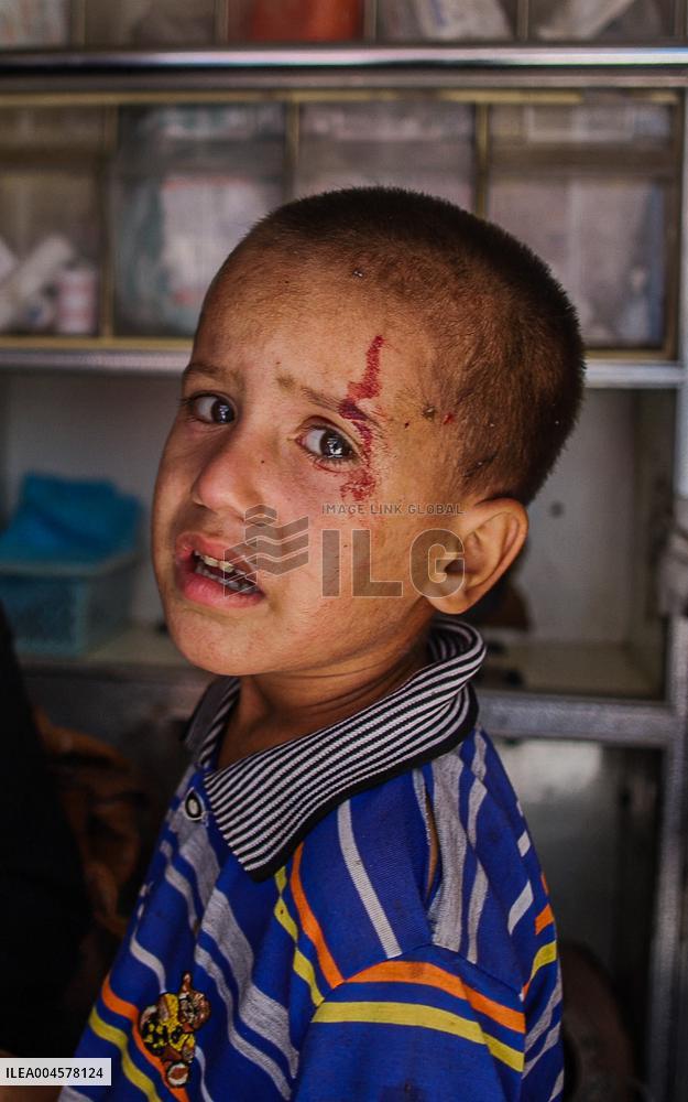 Gaza Airstrike Aftermath - Injured Child in Jabalia