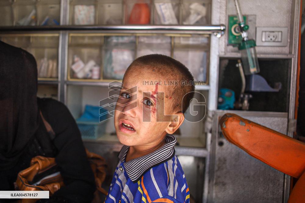 Gaza Airstrike Aftermath - Injured Child in Jabalia