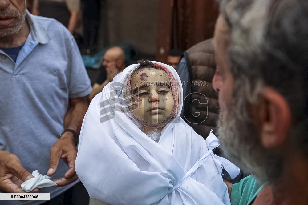 Farewell to a 7-Month-Old Baby - Gaza