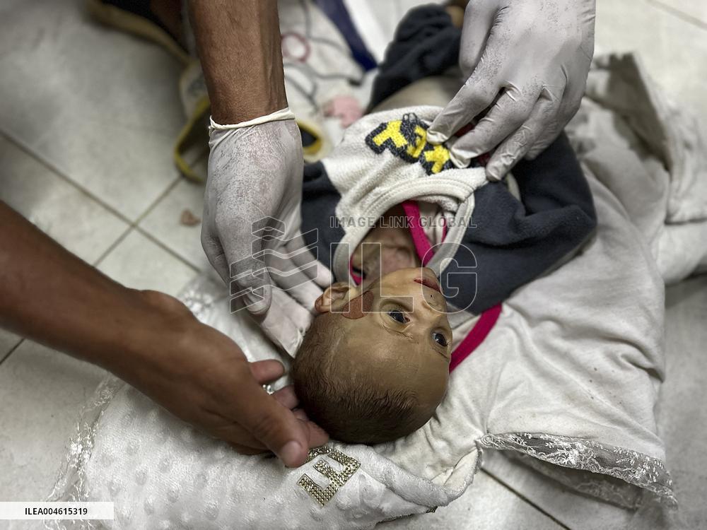 Infant Dies of Malnutrition in Hospital - Khan Yunis