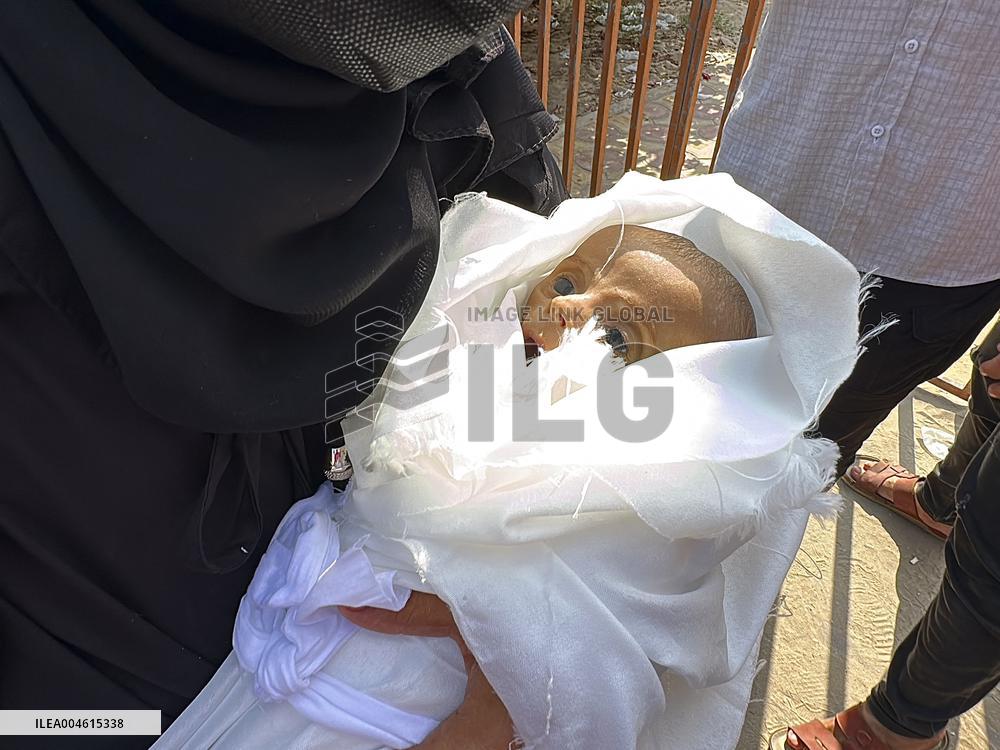 Infant Dies of Malnutrition in Hospital - Khan Yunis