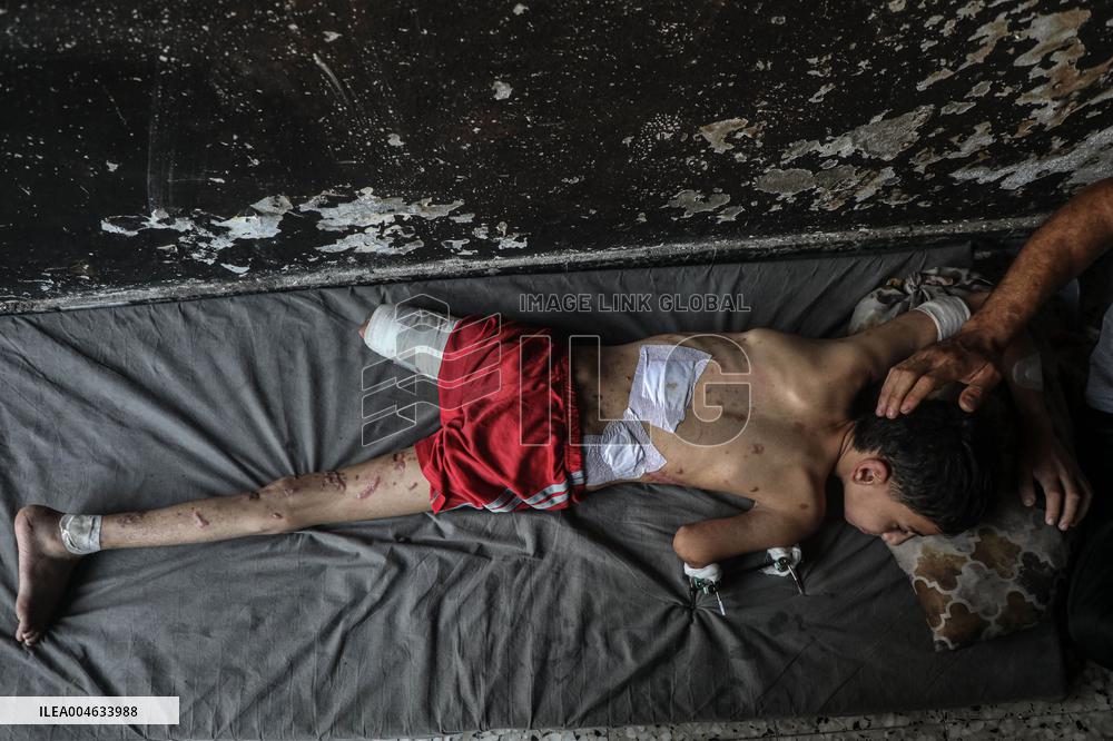 Gaza City Addressing Disability Issues - Gaza