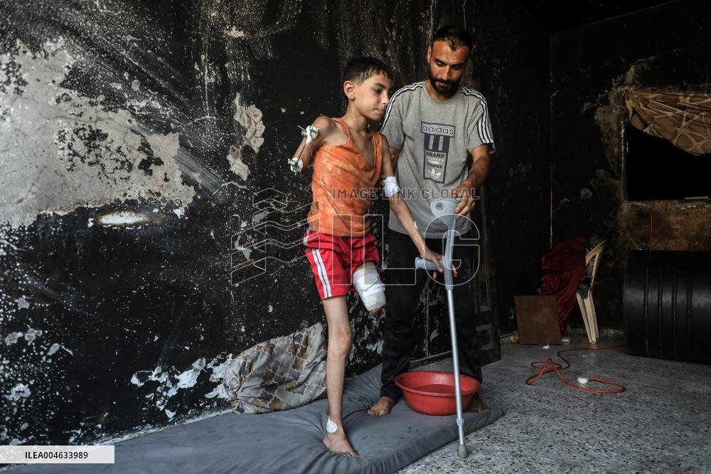 Gaza City Addressing Disability Issues - Gaza