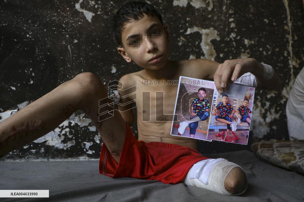 Gaza City Addressing Disability Issues - Gaza