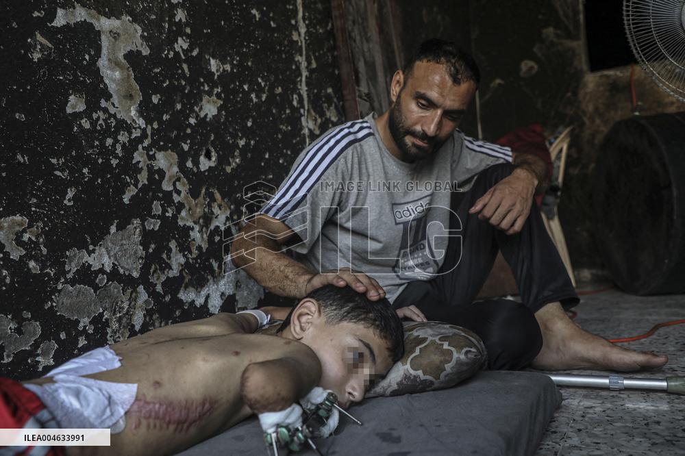 Gaza City Addressing Disability Issues - Gaza