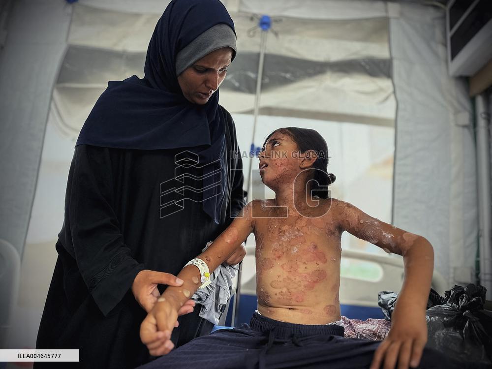 Gaza Children Skin Diseases - Khan Yunis