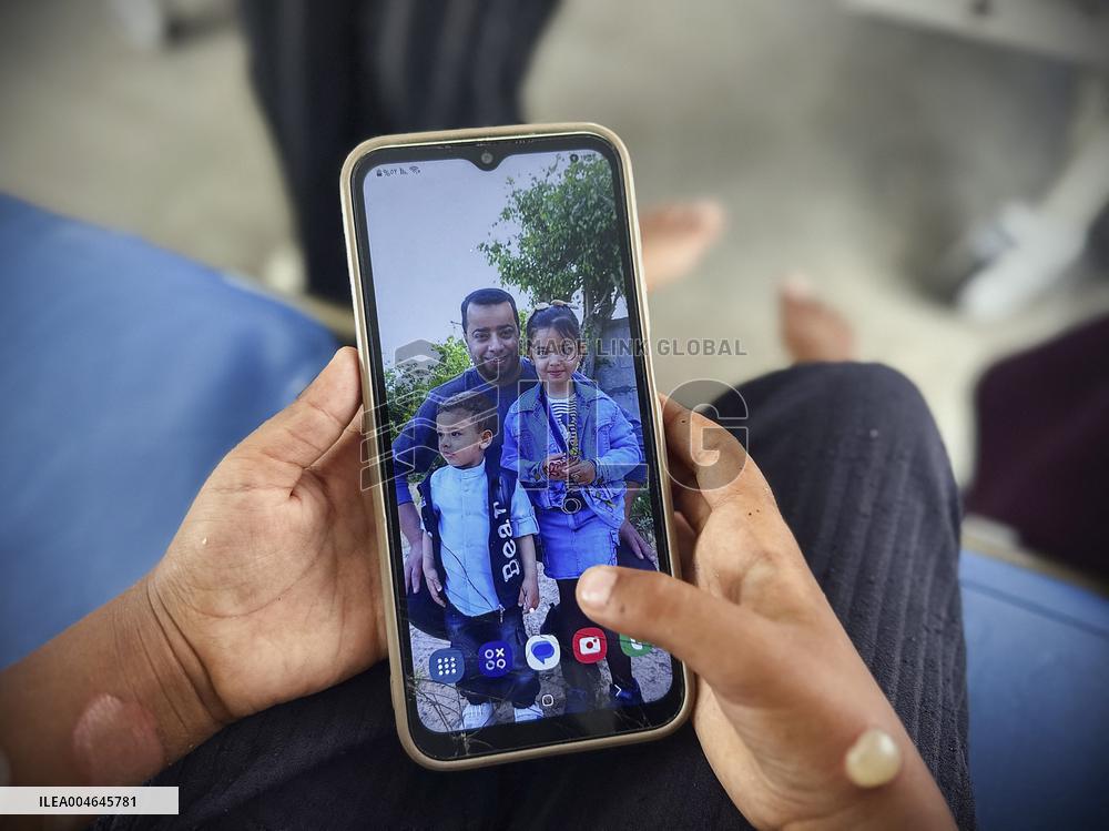 Gaza Children Skin Diseases - Khan Yunis