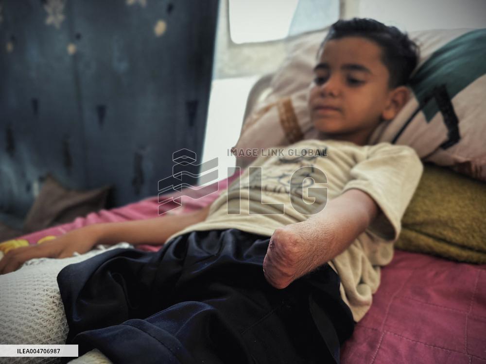 Child Loses Arm in Israel Gaza Conflict