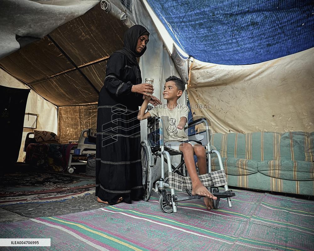 Child Loses Arm in Israel Gaza Conflict