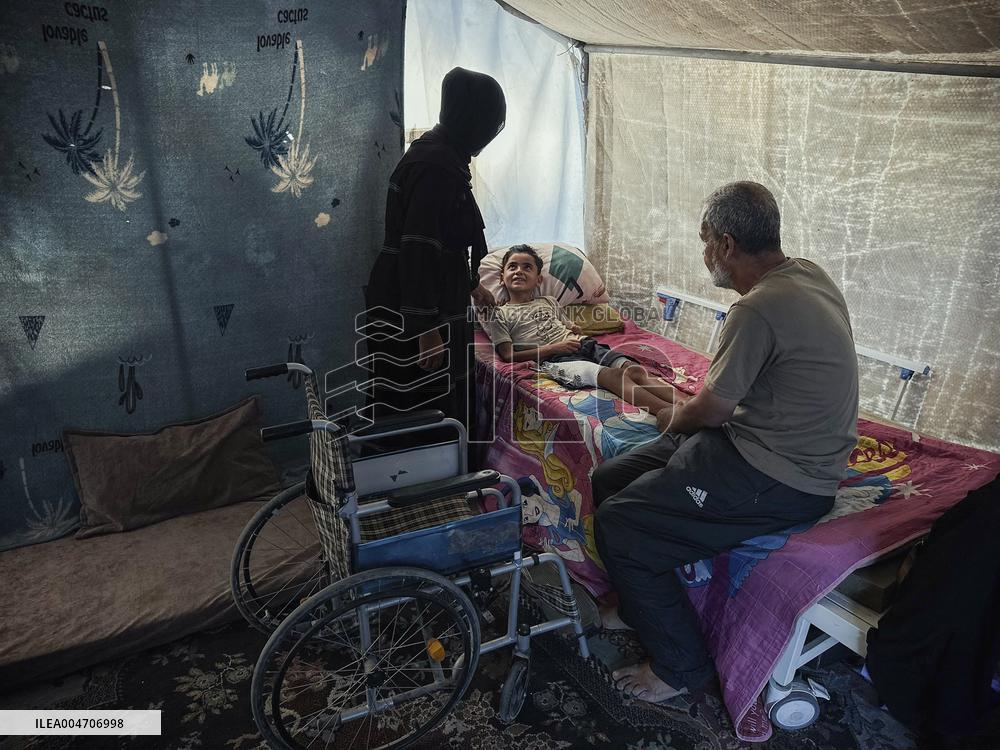 Child Loses Arm in Israel Gaza Conflict