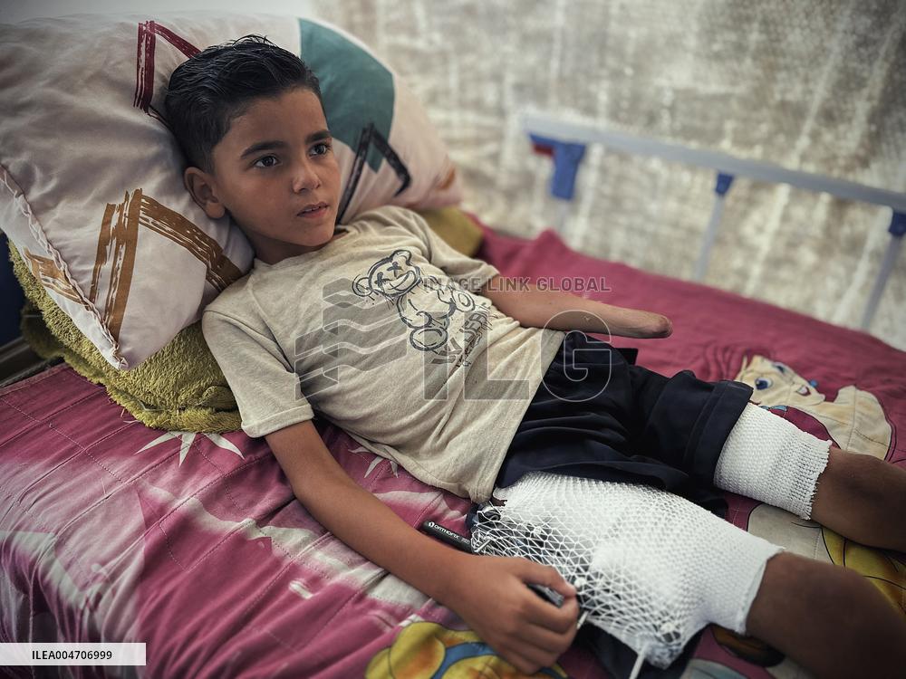 Child Loses Arm in Israel Gaza Conflict