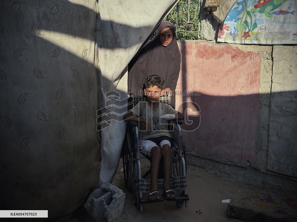 Child Loses Arm in Israel Gaza Conflict