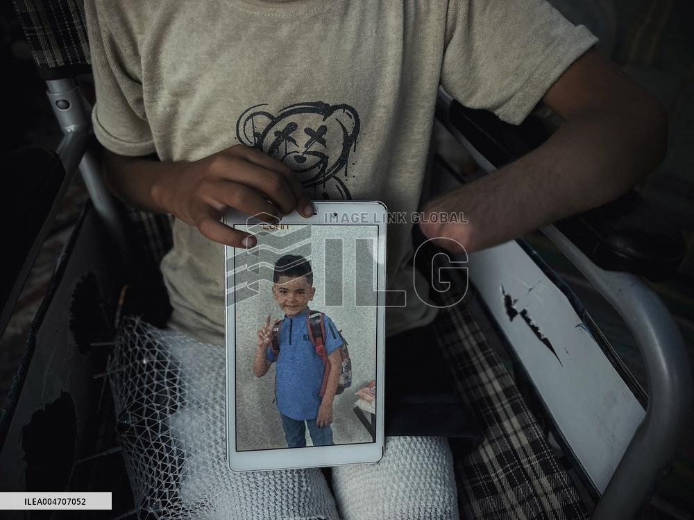 Child Loses Arm in Israel Gaza Conflict