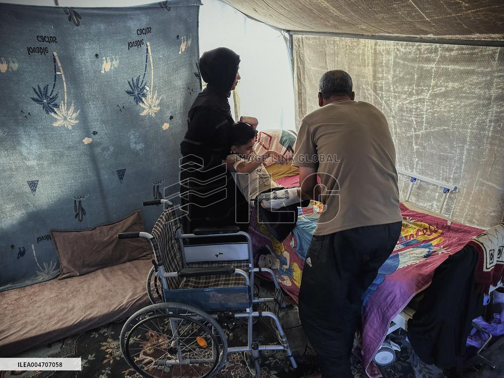 Child Loses Arm in Israel Gaza Conflict